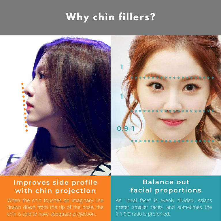 Are chin fillers pricey in Singapore | SL Aesthetic Clinic