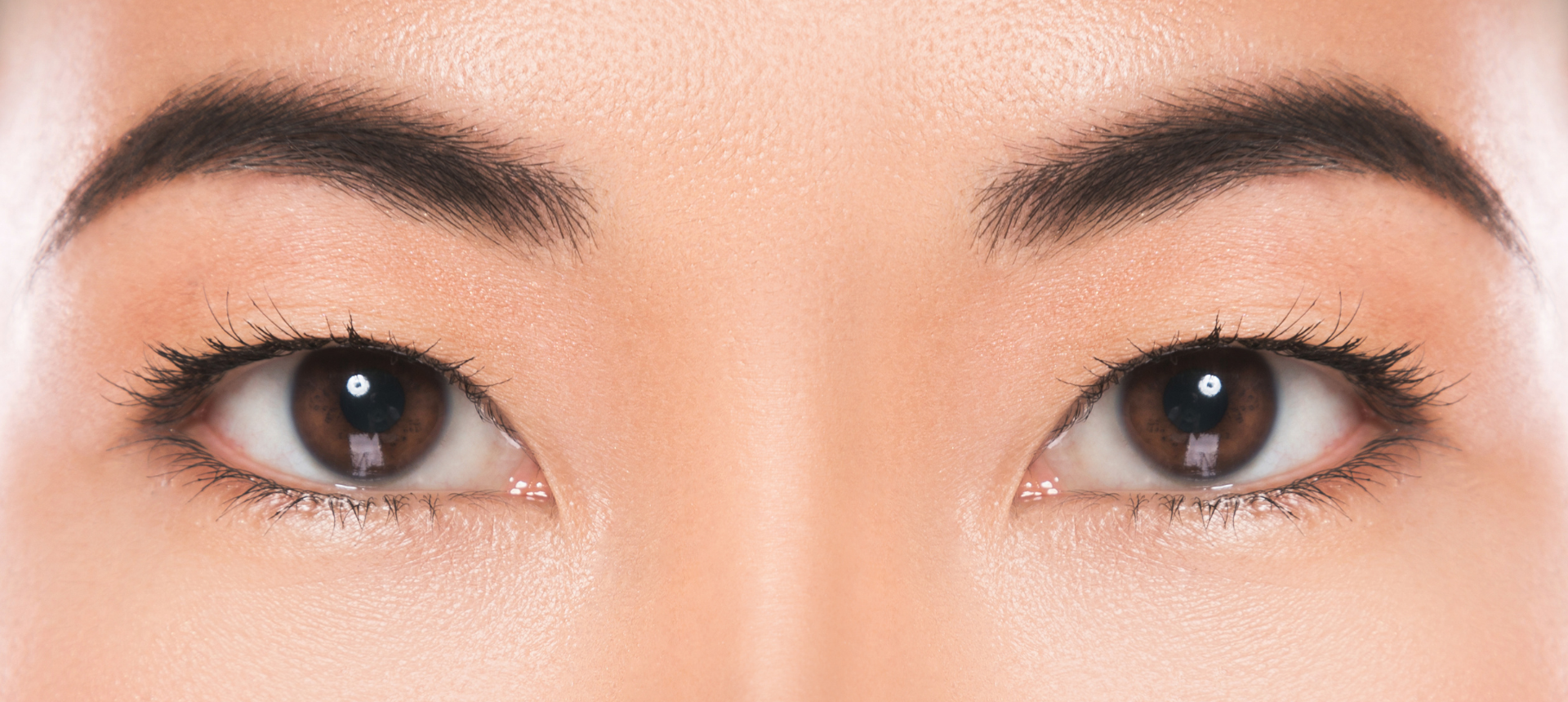 Non-invasive laser lift for brows, eyelids, and forehead
