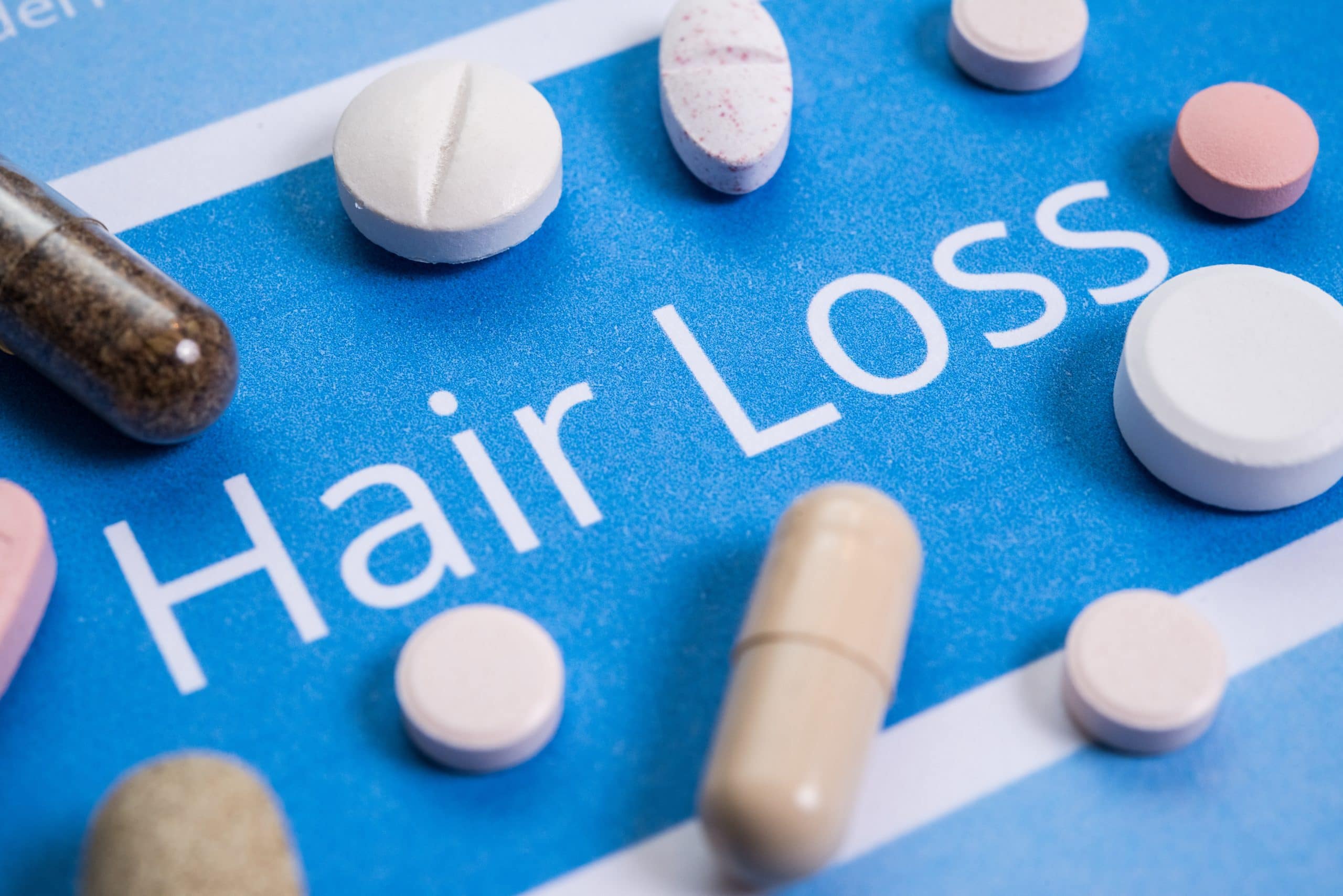 Hair Loss Medications: Types, Effectiveness, and Side Effects - SL  Aesthetic Clinic