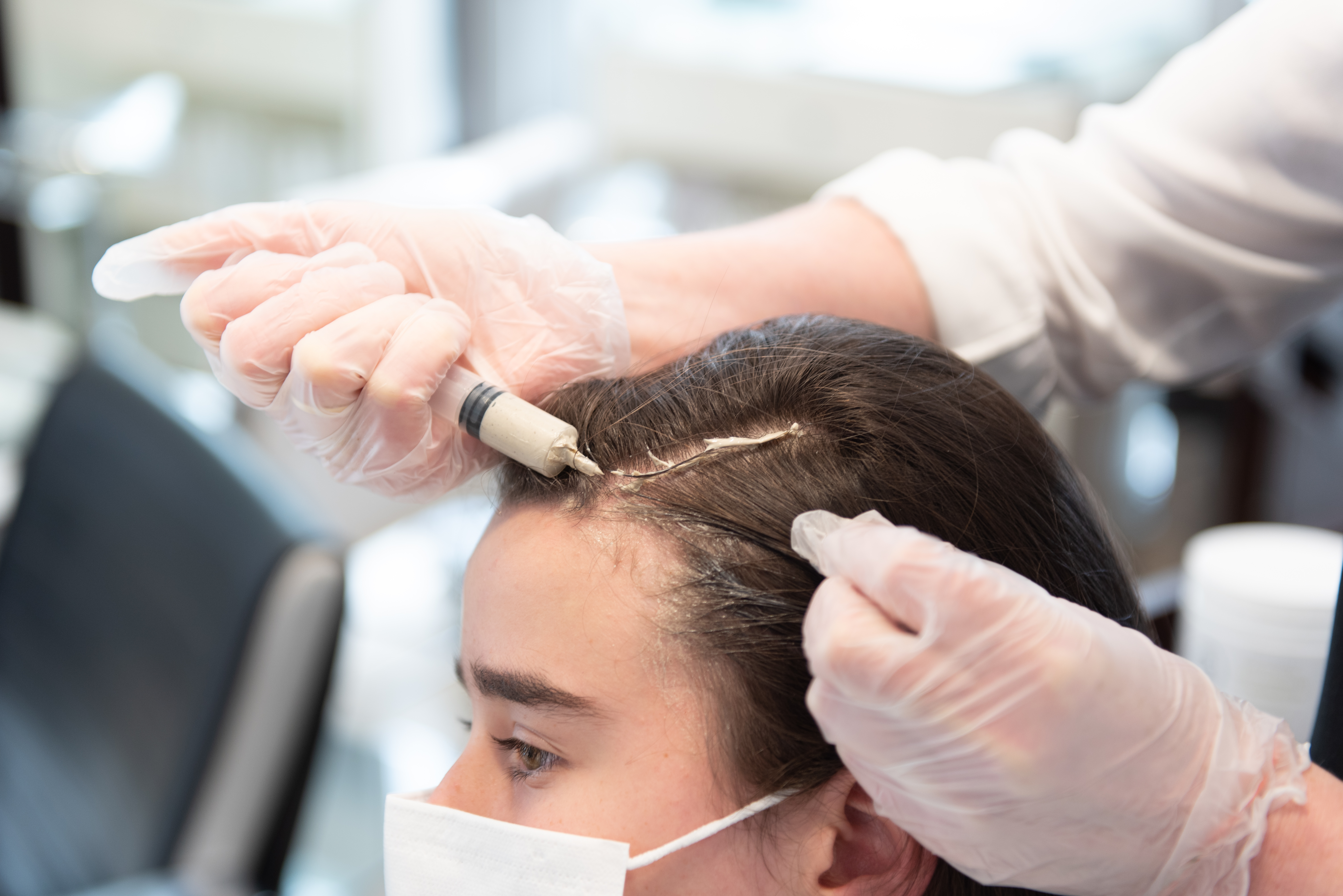 How To Treat Teenage Hair Loss? | SL Aesthetic Clinic