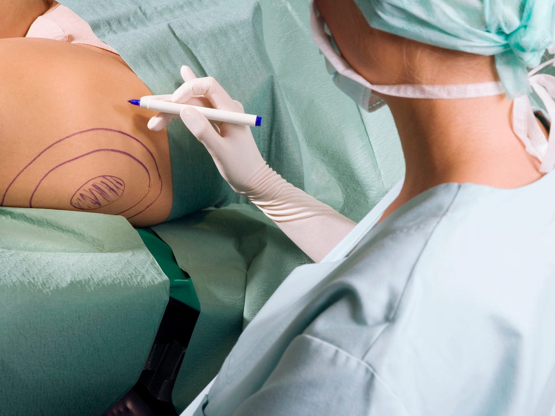 What Is Liposuction