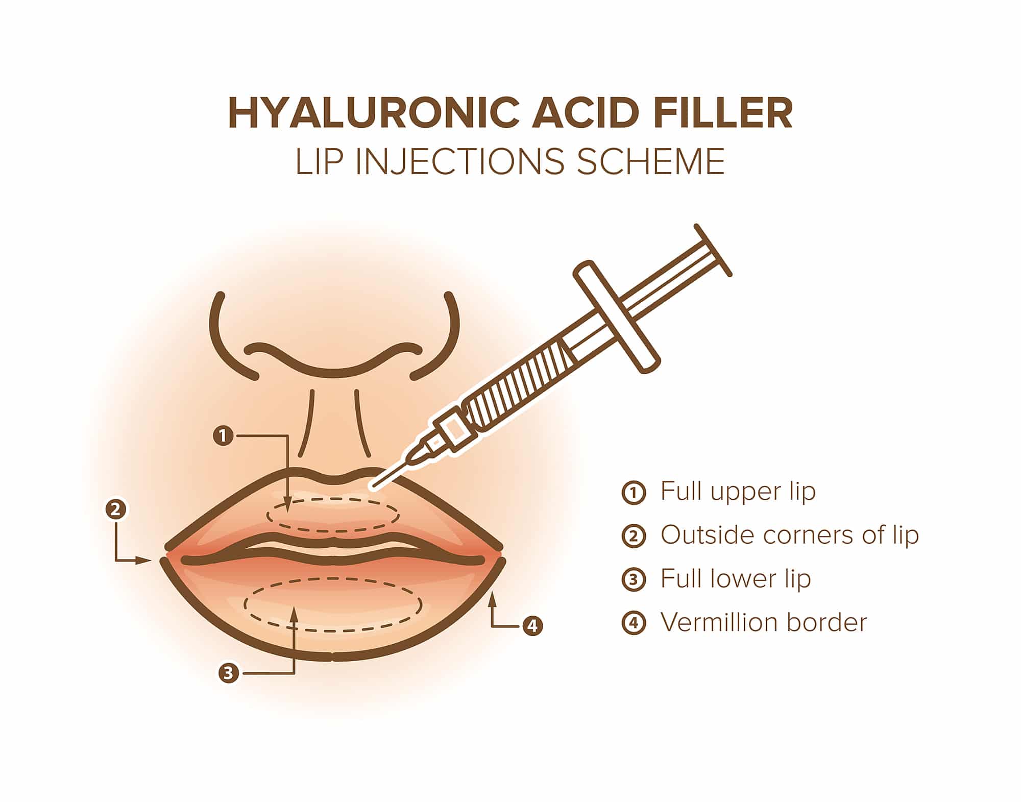 Guide To Lip Fillers Treatment In Singapore Price Cost FAQs