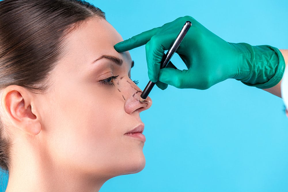 Surgical Nose Jobs