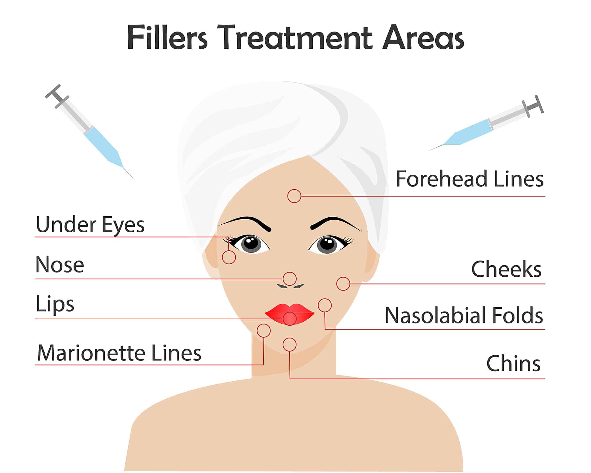 Filler Treatment Areas