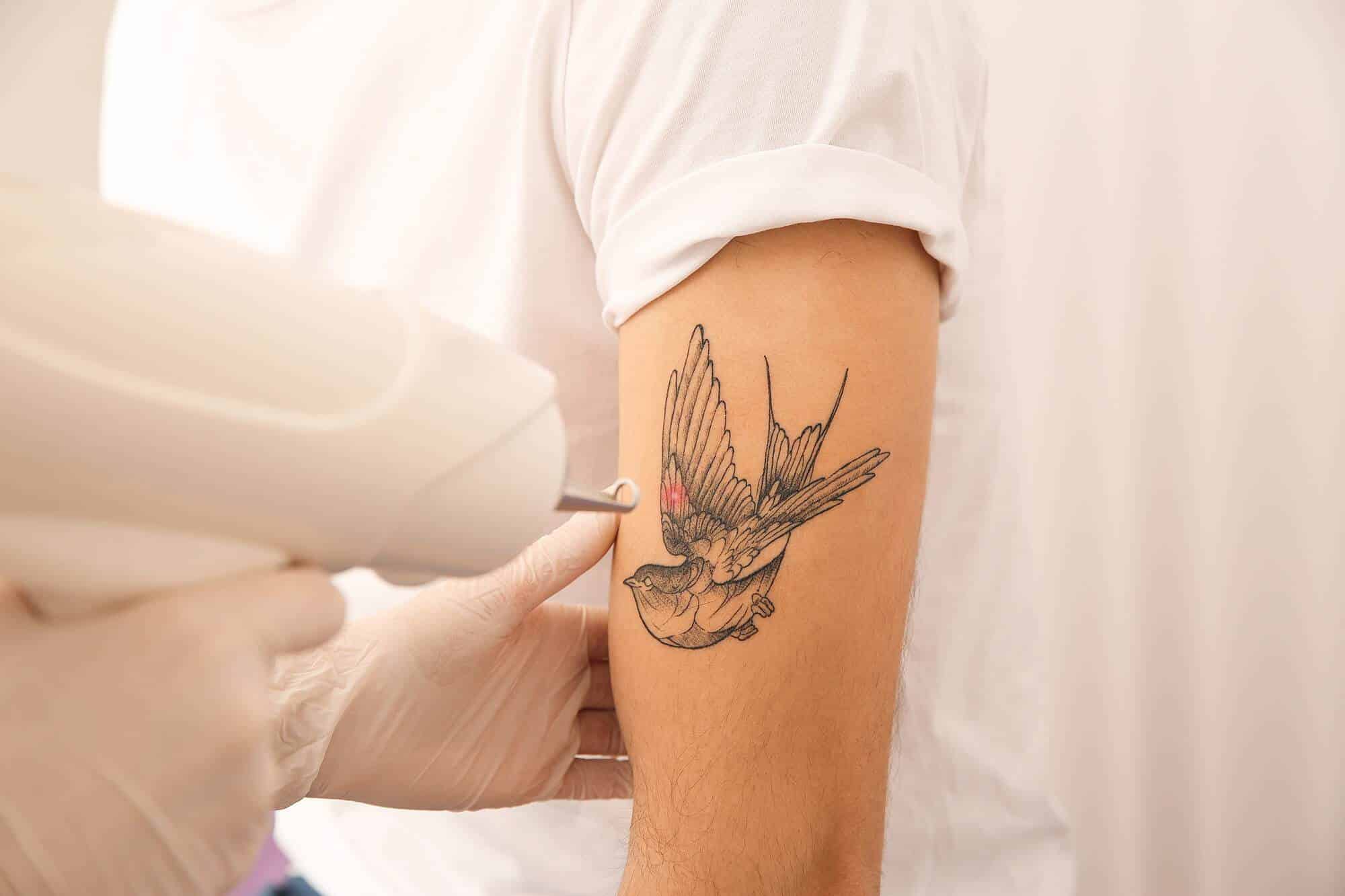 How Pico Laser Helps Remove Tattoos In Singapore