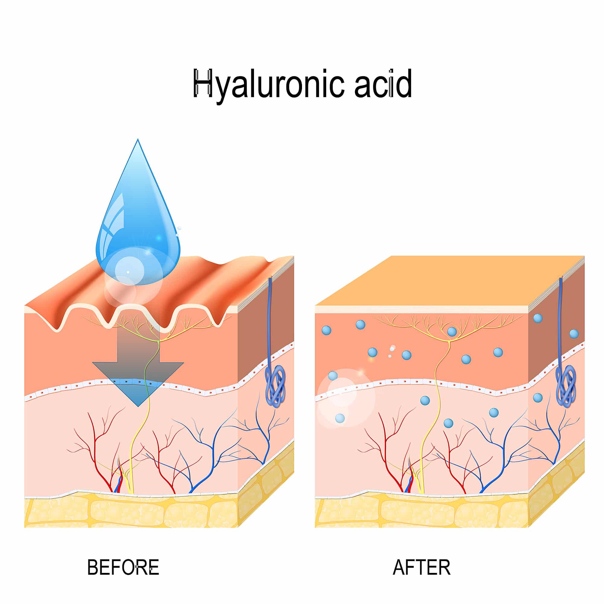 6 Benefits Of Getting Skin Booster Treatments SL Aesthetic Clinic