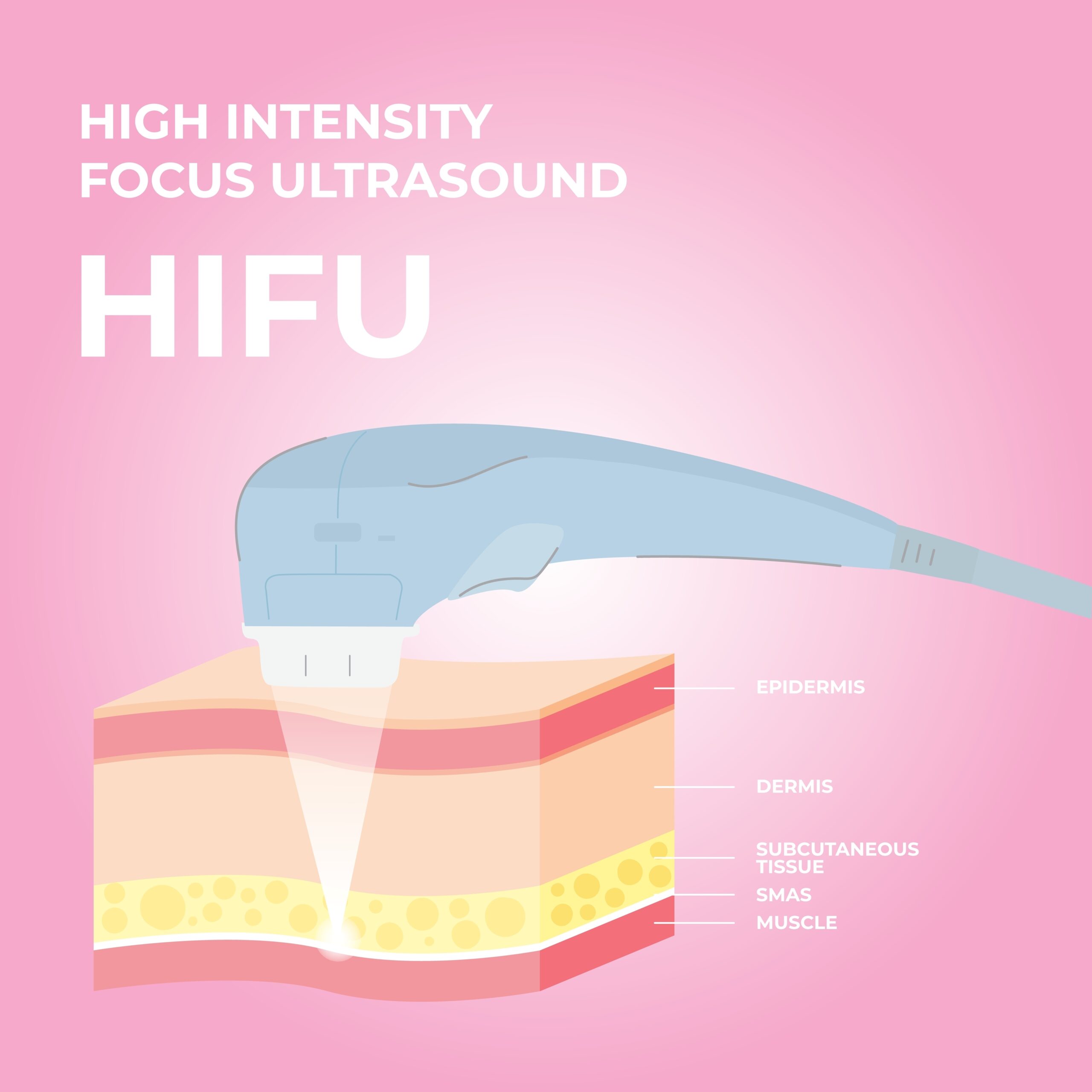 How Does HIFU Help With Facelifting