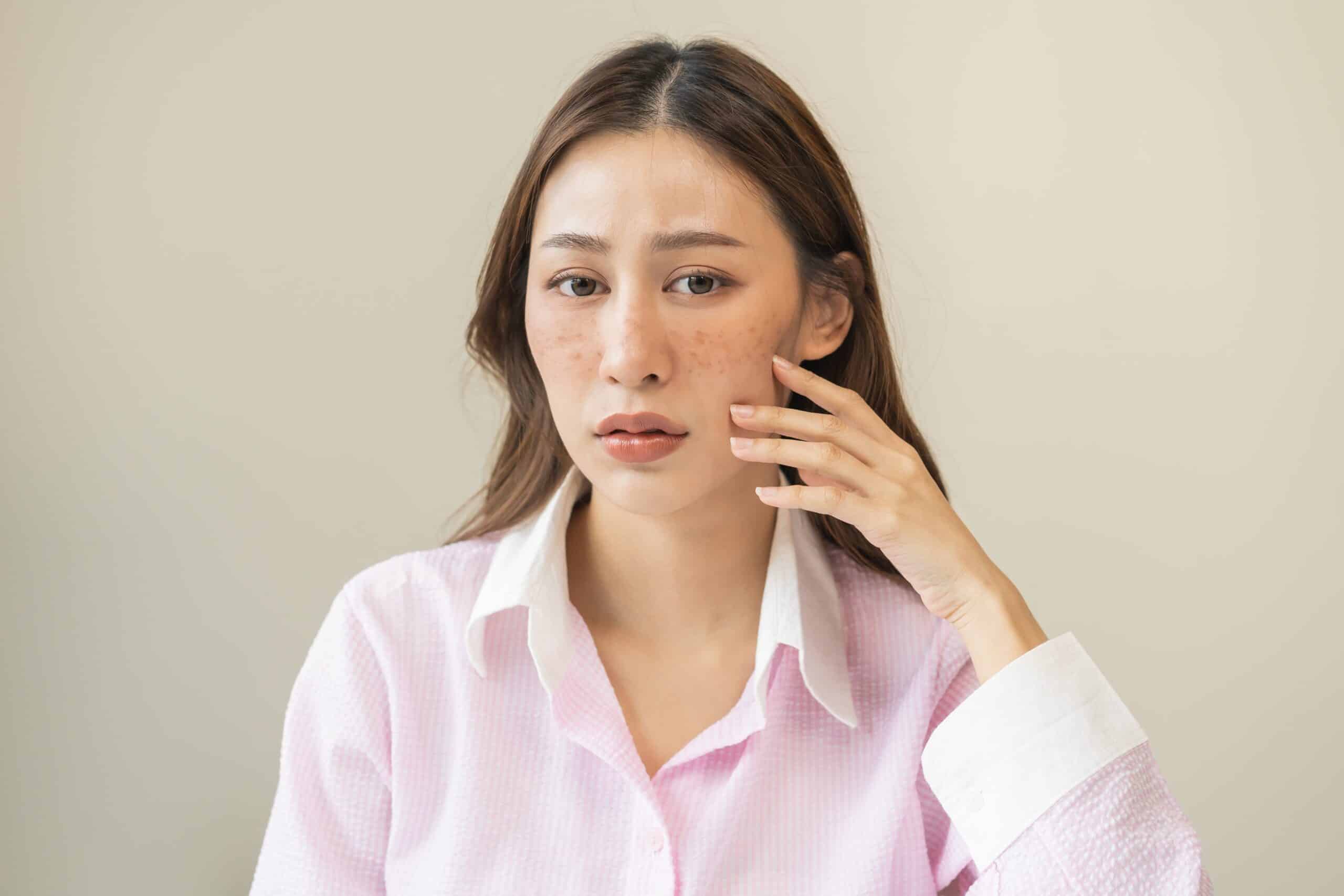 Advantages of Tranexamic Acid Advantages of Tranexamic Acid
