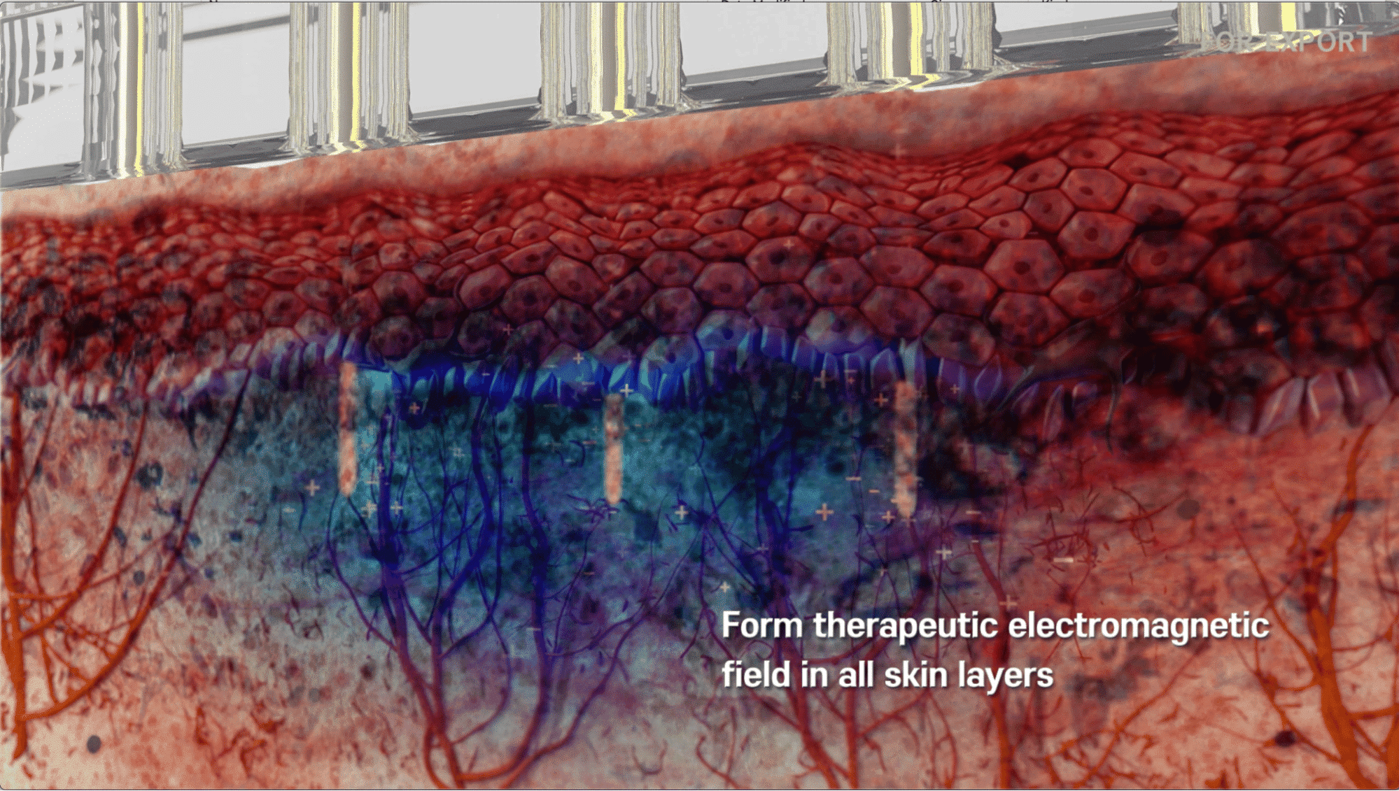 Form Therapeutic Electromagnetic for Skin Layers