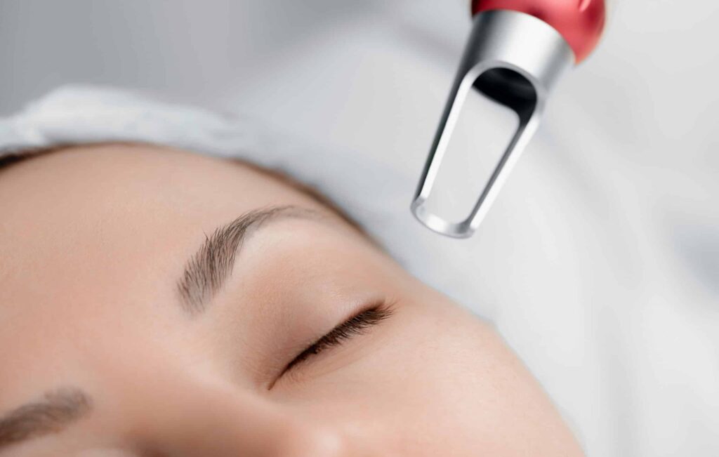 5 Surprising Benefits Of Pico Laser You May Not Know