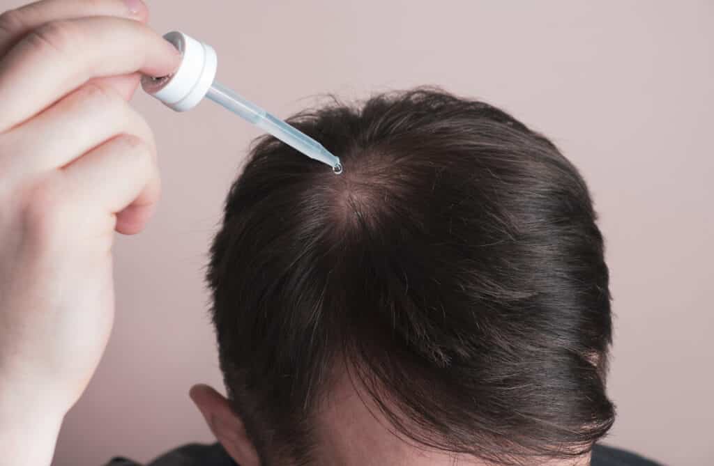 hair loss treatment & medication singapore