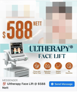 Ultherapy Facelift Price in Singapore