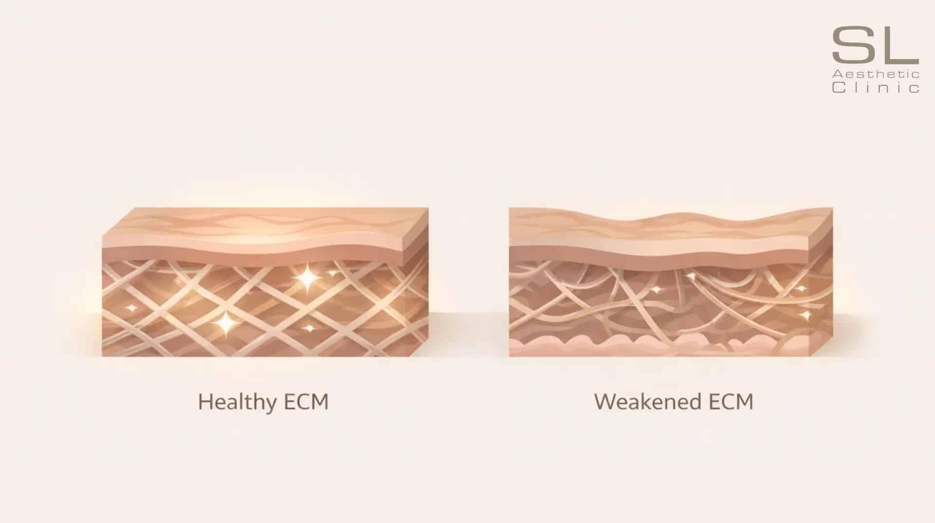 What Is Re20 ECM Skinbooster​ - healthy ecm and weakened ecm