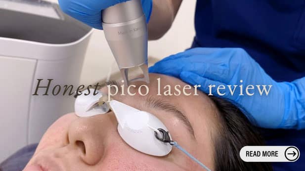 Pico Laser Honest Review - What Kind of Result can I Expect in a Pico Laser