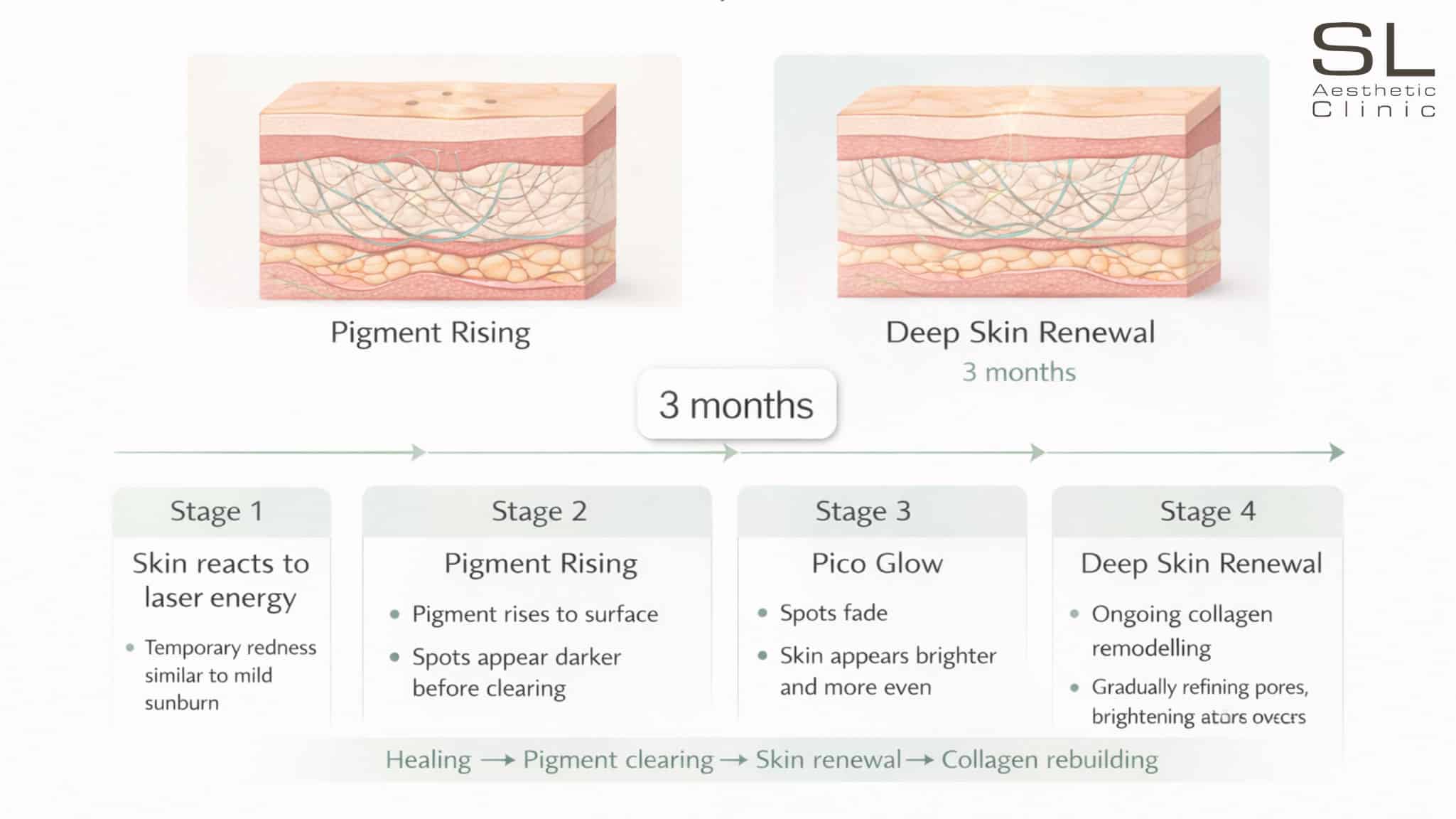 Pico Laser Recovery & Result Timeline Diagram