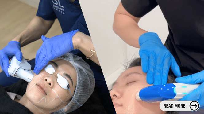 Comparison of Ultherapy and HIFU Treatment