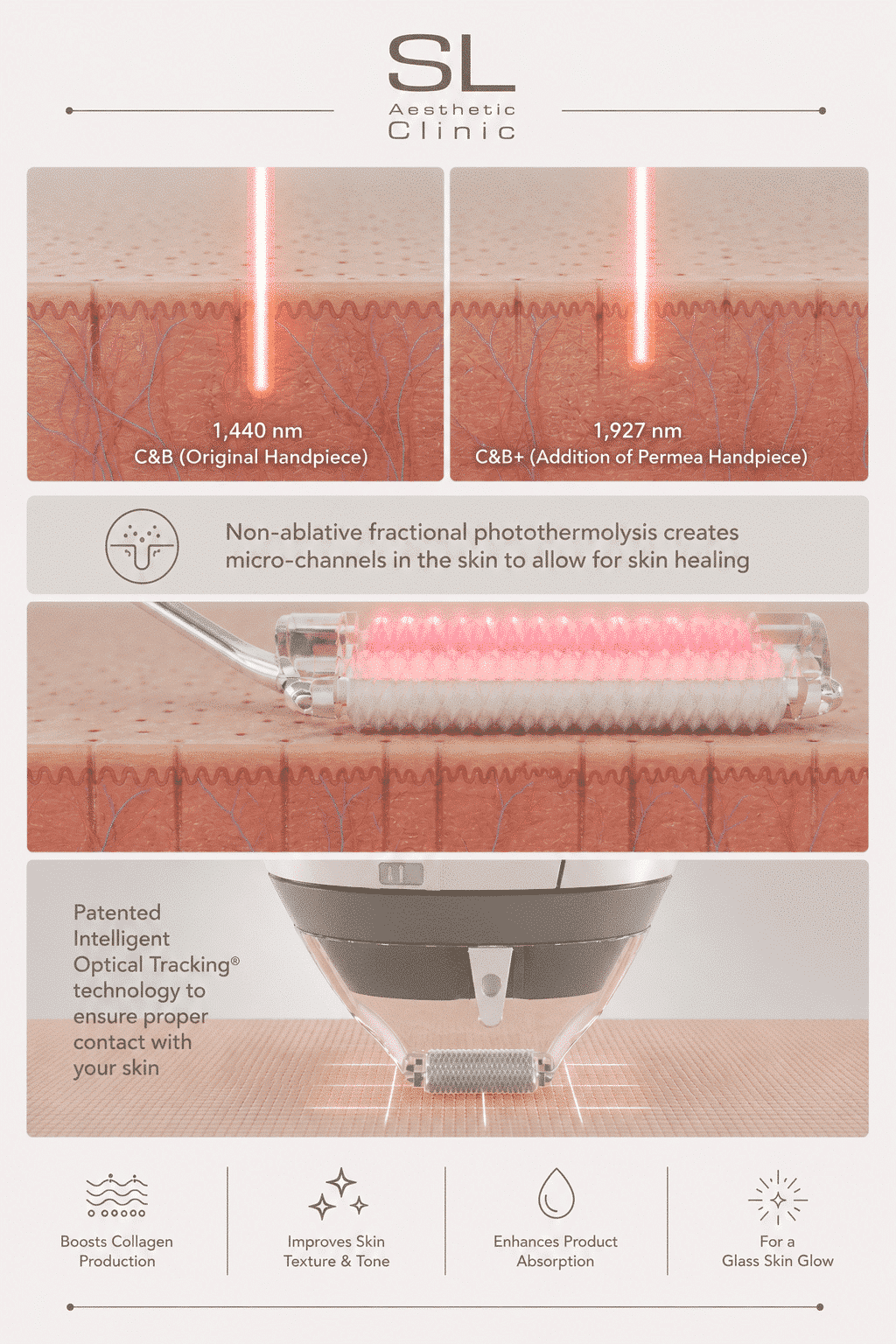 How Clear & Brilliant Laser works