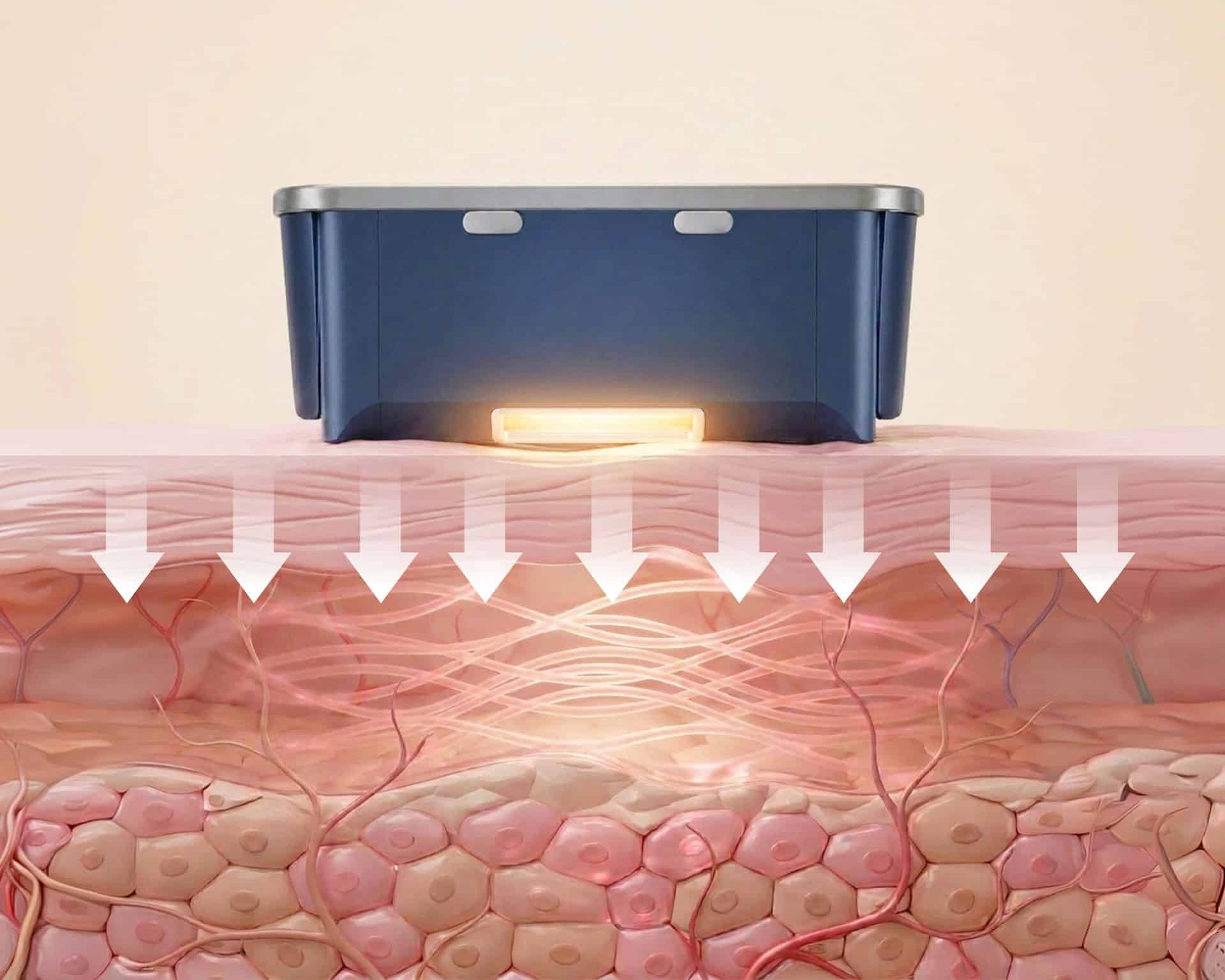 An infographics showing the Collagen Contraction Effect.