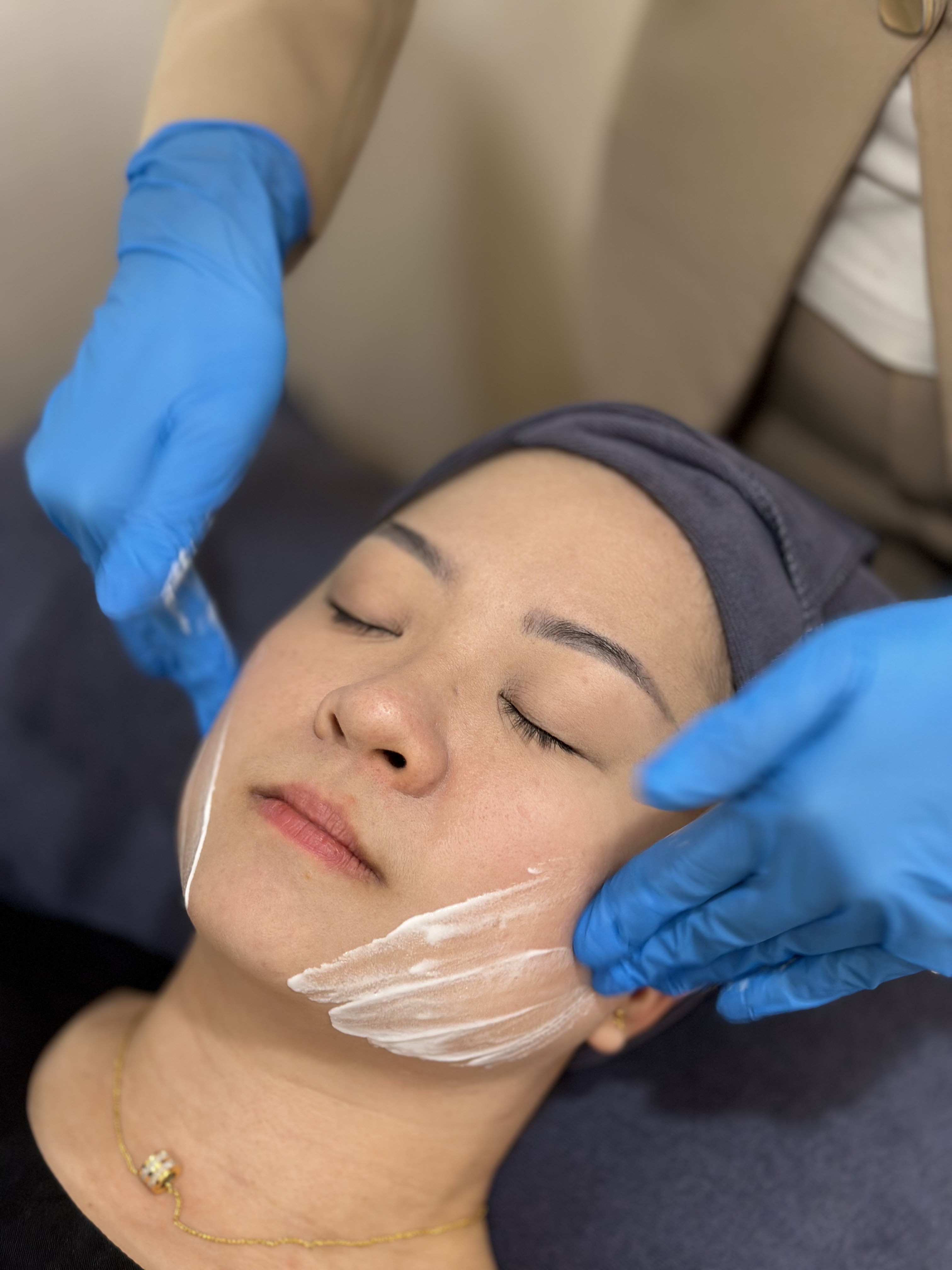 Skin Preparation for XERF Treatment