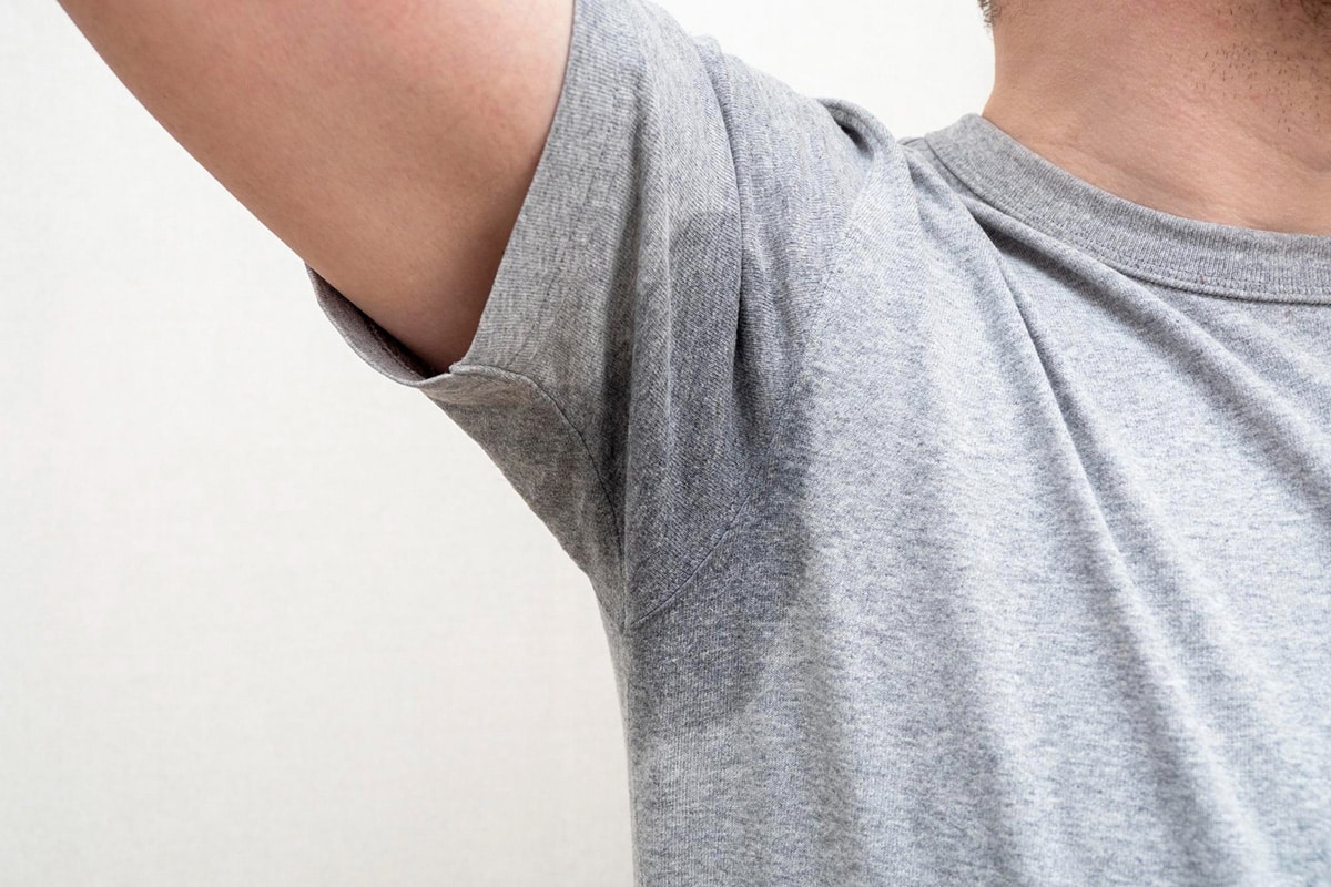 A person showing his underarm with excessive sweating needing miraDry treatment
